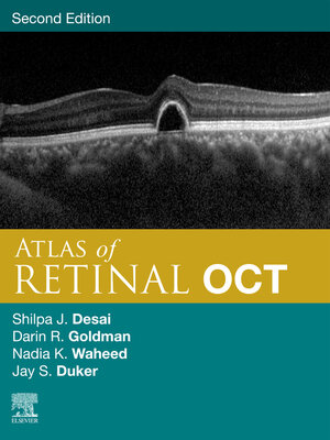 cover image of Atlas of Retinal OCT E-Book